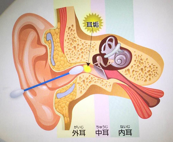 耳の構造と耳垢（みみあか）